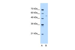 Aviva Systems Biology Corp MLSTD1 Antibody - C-terminal region (ARP47392_P050)