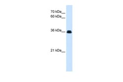 Aviva Systems Biology Corp eve Antibody - N-terminal region (ARP47848_P050)