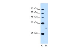 Aviva Systems Biology Corp NANOG Antibody - N-terminal region (ARP47988_P050)