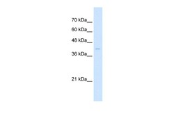 Aviva Systems Biology Corp ARRB2 Antibody - middle region (ARP48007_P050)