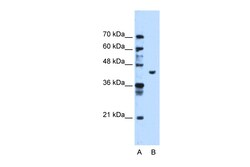 Aviva Systems Biology Corp PGK1 Antibody - C-terminal region (ARP48141_T100)
