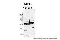 Aviva Systems Biology Corp ATP5F1B Antibody - C-terminal region (ARP48186_T100)