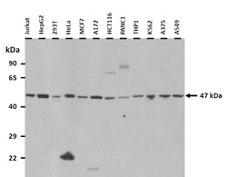 Aviva Systems Biology Corp ENO3 Antibody - N-terminal region (ARP48203_T100)