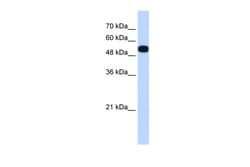 Aviva Systems Biology Corp UGP2 Antibody - N-terminal region (ARP48303_P050)