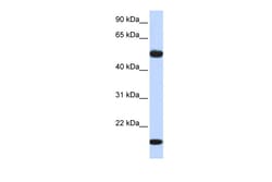 Aviva Systems Biology Corp ADSSL1 Antibody - middle region (ARP48442_P050)