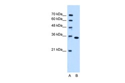 Aviva Systems Biology Corp TYMS Antibody - C-terminal region (ARP48543_P050)