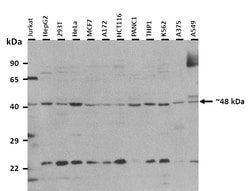 Aviva Systems Biology Corp GATM Antibody - middle region (ARP48553_P050)