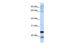Aviva Systems Biology Corp GSTA4 Antibody - C-terminal region (ARP48555_P050)