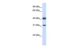 Aviva Systems Biology Corp PDSS2 Antibody - C-terminal region (ARP48856_P050)