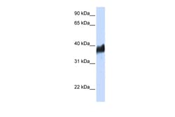 Aviva Systems Biology Corp CLN8 Antibody - N-terminal region (ARP49409_P050)