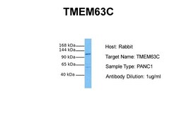 Aviva Systems Biology Corp TMEM63C Antibody - middle region (ARP49506_P050)