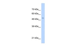 Aviva Systems Biology Corp C11orf24 Antibody - N-terminal region (ARP49708_P050)