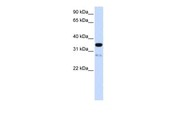 Aviva Systems Biology Corp TMEM38A Antibody - N-terminal region (ARP49799_P050)