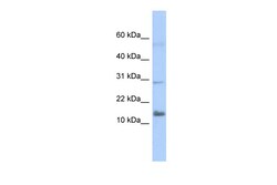 Aviva Systems Biology Corp FAM14A Antibody - middle region (ARP50027_P050)