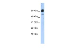 Aviva Systems Biology Corp ABAT Antibody - middle region (ARP51765_P050)