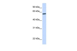 Aviva Systems Biology Corp CYP27A1 Antibody - middle region (ARP51773_P050)