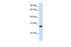 Aviva Systems Biology Corp DCK Antibody - middle region (ARP51775_P050)