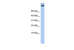 Aviva Systems Biology Corp COPA Antibody - middle region (ARP51894_P050)