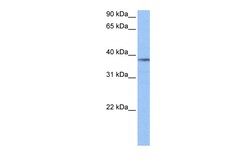 Aviva Systems Biology Corp NUDC Antibody - middle region (ARP52205_P050)