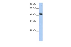 Aviva Systems Biology Corp ICA1L Antibody - middle region (ARP52622_P050)