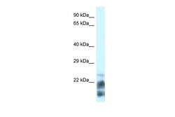 Aviva Systems Biology Corp MDP-1 Antibody - N-terminal region (ARP52625_P050)