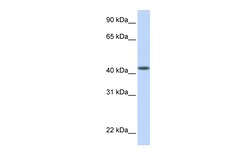 Aviva Systems Biology Corp DENND1B Antibody - N-terminal region (ARP52770_P050)