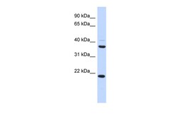 Aviva Systems Biology Corp TMEM74 Antibody - middle region (ARP53131_P050)