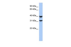 Aviva Systems Biology Corp C5orf35 Antibody - N-terminal region (ARP53194_P050)