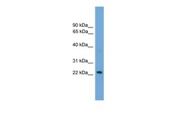 Aviva Systems Biology Corp RAB39B Antibody - N-terminal region (ARP53210_P050)