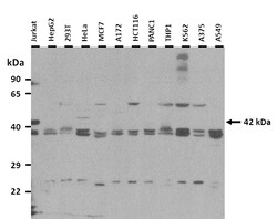 Aviva Systems Biology Corp ST6GALNAC2 Antibody - middle region (ARP53653_P050)