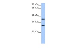 Aviva Systems Biology Corp LGALS8 Antibody - C-terminal region (ARP53656_P050)
