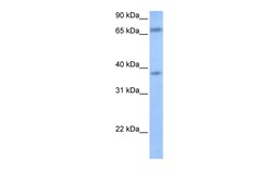 Aviva Systems Biology Corp FEM1B Antibody - middle region (ARP53702_P050)