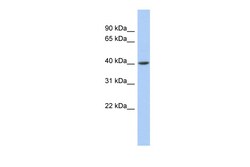 Aviva Systems Biology Corp ACADS Antibody - middle region (ARP54276_P050)