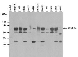Aviva Systems Biology Corp ERCC5 Antibody - N-terminal region (ARP54287_P050)