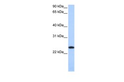 Aviva Systems Biology Corp FTL Antibody - middle region (ARP54292_P050)