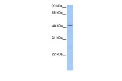 Aviva Systems Biology Corp HMBS Antibody - middle region (ARP54452_P050)
