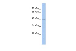 Aviva Systems Biology Corp FLJ33790 Antibody - N-terminal region (ARP54502_P050)