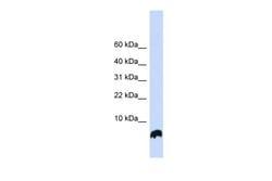 Aviva Systems Biology Corp GLRX Antibody - N-terminal region (ARP54626_P050)