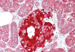 Aviva Systems Biology Corp PHGDH Antibody - middle region (ARP54801_P050)