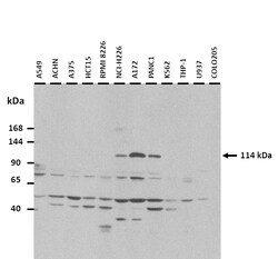 Aviva Systems Biology Corp SMG5 Antibody - N-terminal region (ARP55229_P050)