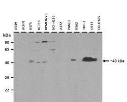 Aviva Systems Biology Corp SSBP3 Antibody - middle region (ARP55355_P050)