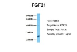 Aviva Systems Biology Corp FGF21 Antibody - N-terminal region (ARP55368_P050)