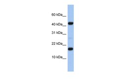 Aviva Systems Biology Corp FLJ37543 Antibody - N-terminal region (ARP55683_P050)