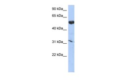 Aviva Systems Biology Corp CYP4X1 Antibody - middle region (ARP55763_P050)
