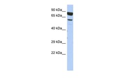 Aviva Systems Biology Corp DPY19L4 Antibody - middle region (ARP55806_P050)