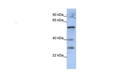 Aviva Systems Biology Corp GADL1 Antibody - middle region (ARP56000_P050)