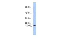Aviva Systems Biology Corp RPL30 Antibody - middle region (ARP56133_P050)