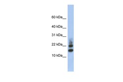 Aviva Systems Biology Corp RPS15A Antibody - middle region (ARP56227_P050)