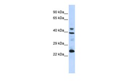 Aviva Systems Biology Corp SELENOP Antibody - N-terminal region (ARP56299_P050)