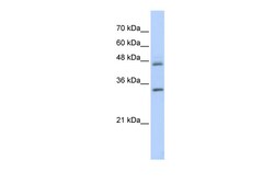 Aviva Systems Biology Corp PRELP Antibody - middle region (ARP56412_P050)